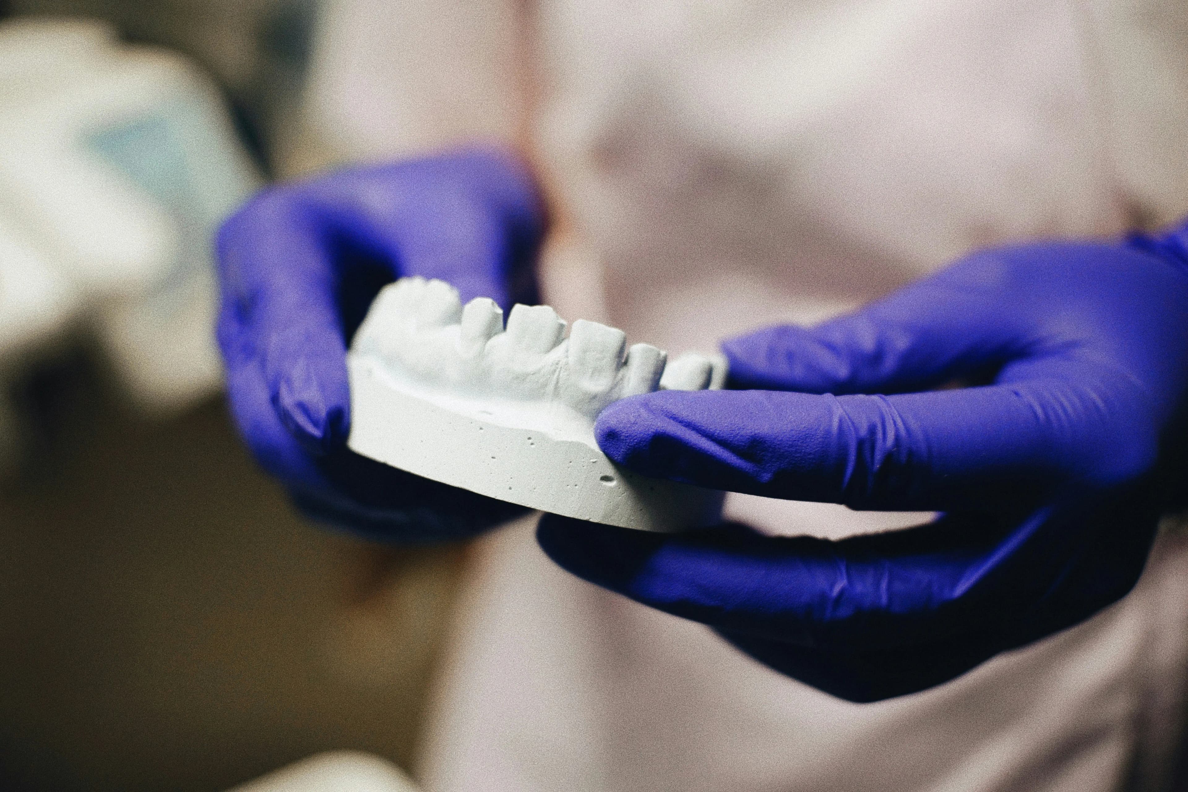 Dental Bonding Services