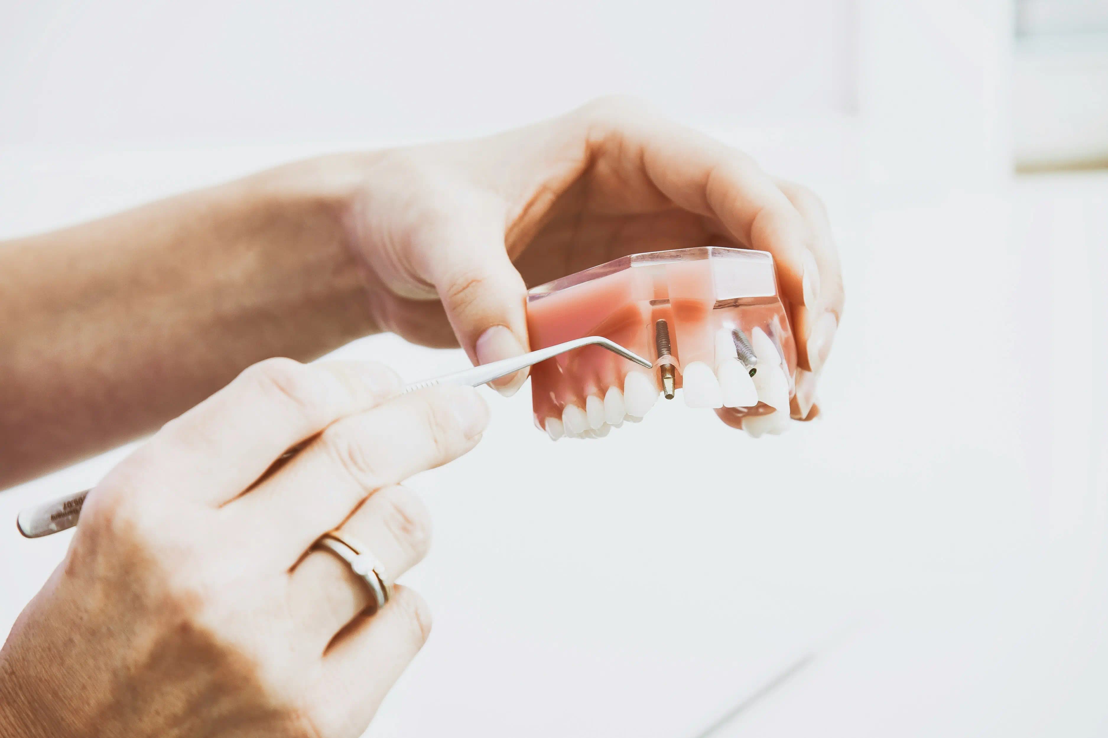 Restore Your Smile with Dentures