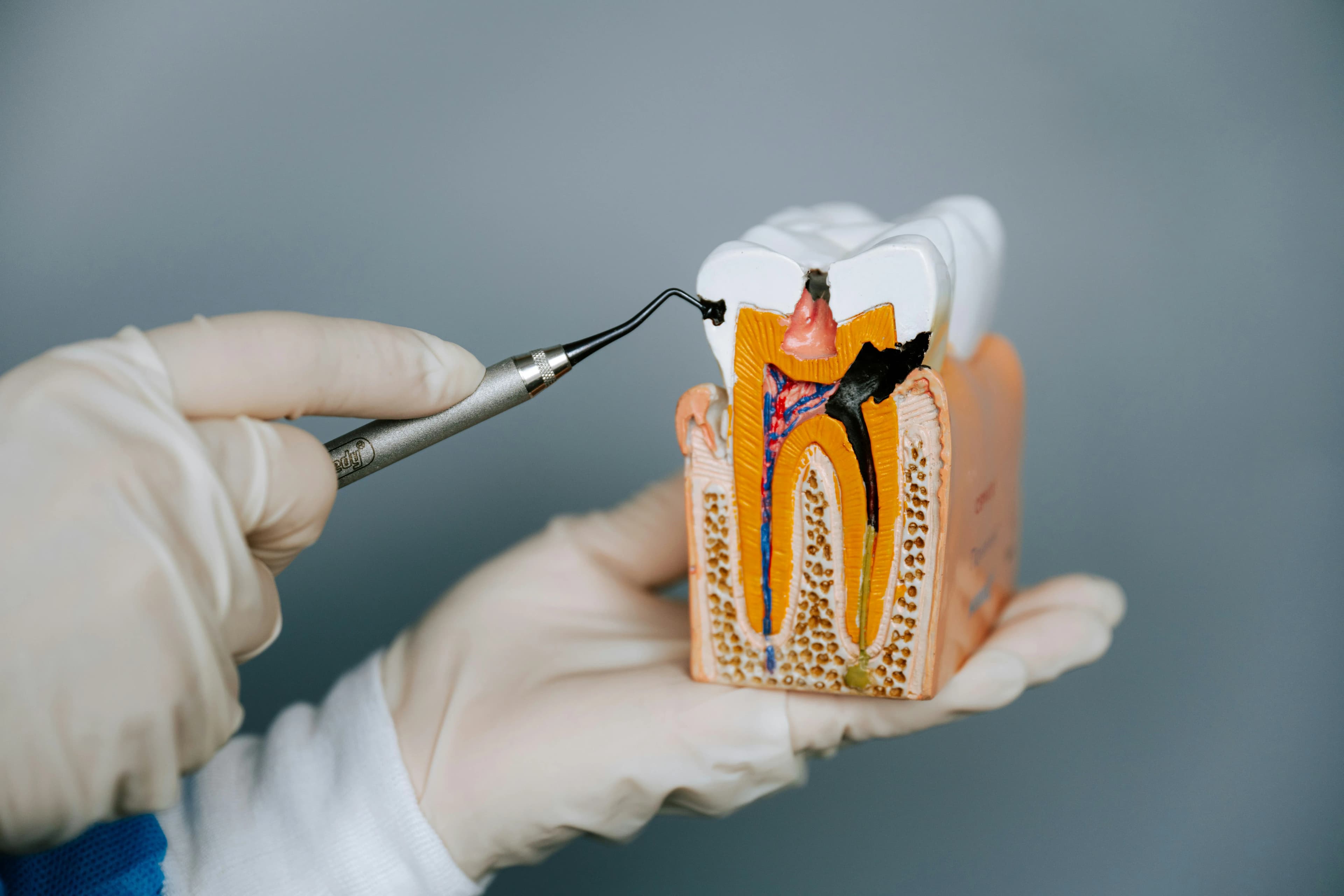 Periodontal Dentist Treatments