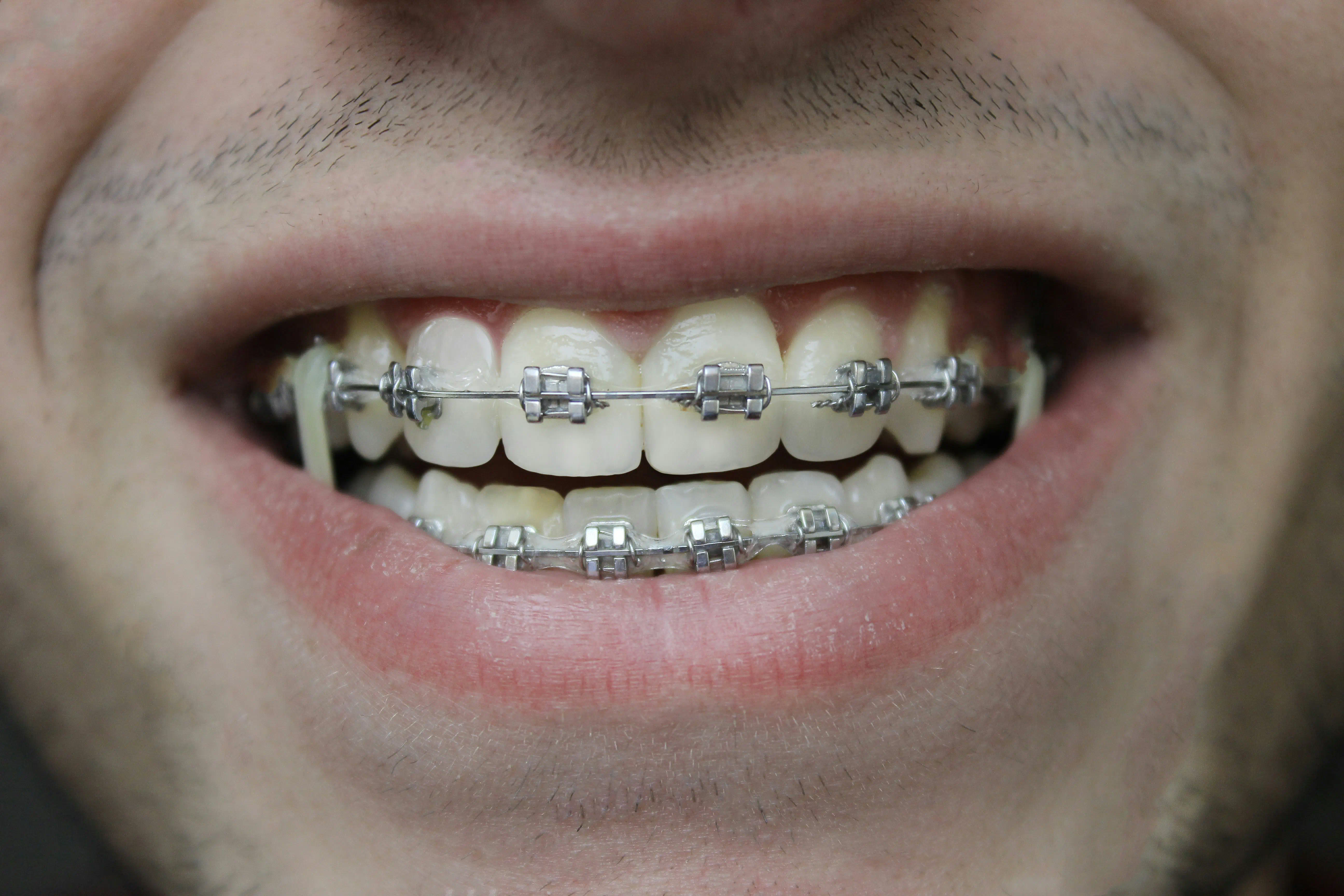 Orthodontic Services and Treatments